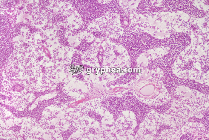 Ganglion lymphatique x25 - gryphea.org